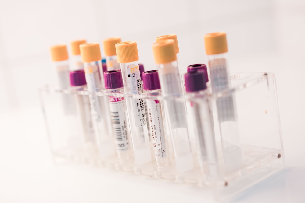 hausarzt-düsseldorf-flingern-laboruntersuchungen hausarzt-düsseldorf-flingern-laboruntersuchungen